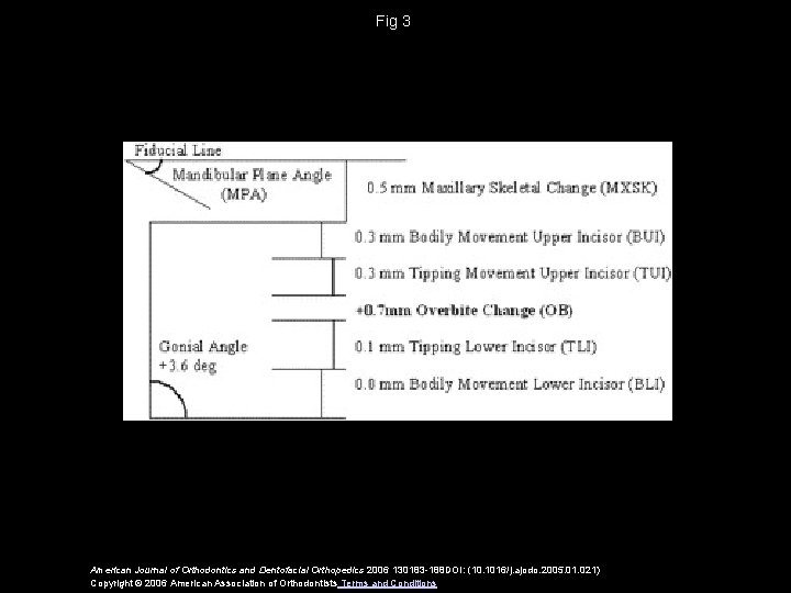 Fig 3 American Journal of Orthodontics and Dentofacial Orthopedics 2006 130183 -188 DOI: (10.