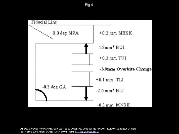 Fig 4 American Journal of Orthodontics and Dentofacial Orthopedics 2006 130183 -188 DOI: (10.