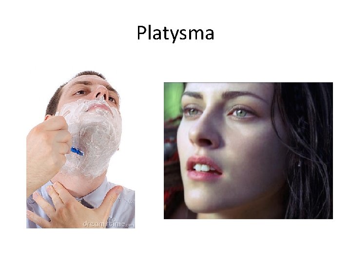 Platysma 