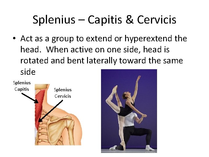 Splenius – Capitis & Cervicis • Act as a group to extend or hyperextend