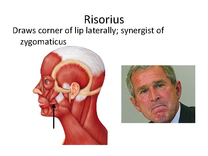 Risorius Draws corner of lip laterally; synergist of zygomaticus 