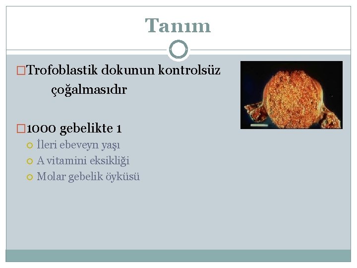 Tanım �Trofoblastik dokunun kontrolsüz çoğalmasıdır � 1000 gebelikte 1 İleri ebeveyn yaşı A vitamini