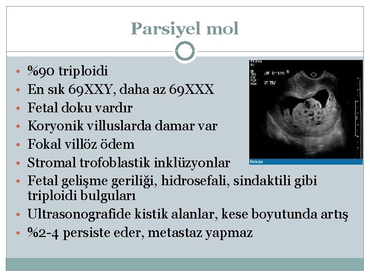 Parsiyel mol • %90 triploidi • En sık 69 XXY, daha az 69 XXX