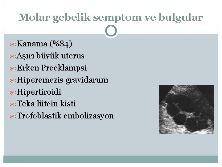 Molar gebelik semptom ve bulgular Kanama (%84) Aşırı büyük uterus Erken Preeklampsi Hiperemezis gravidarum