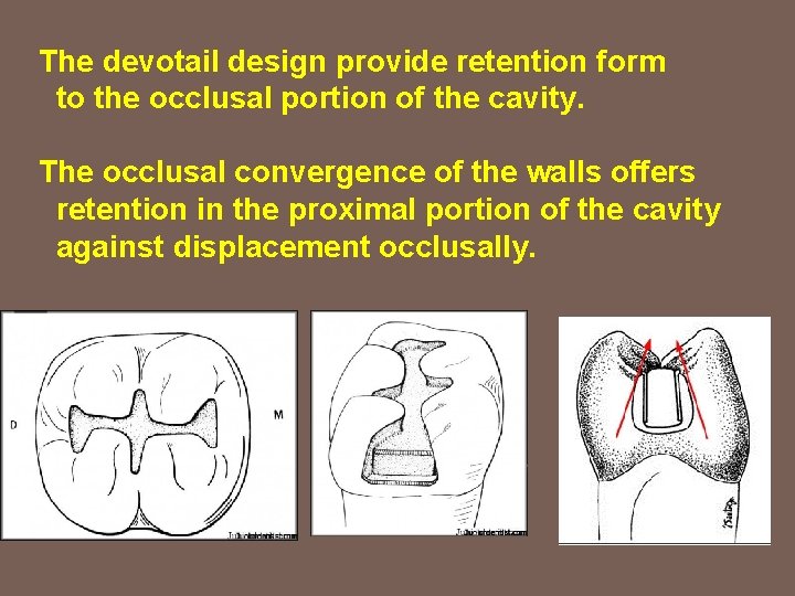 The devotail design provide retention form to the occlusal portion of the cavity. The