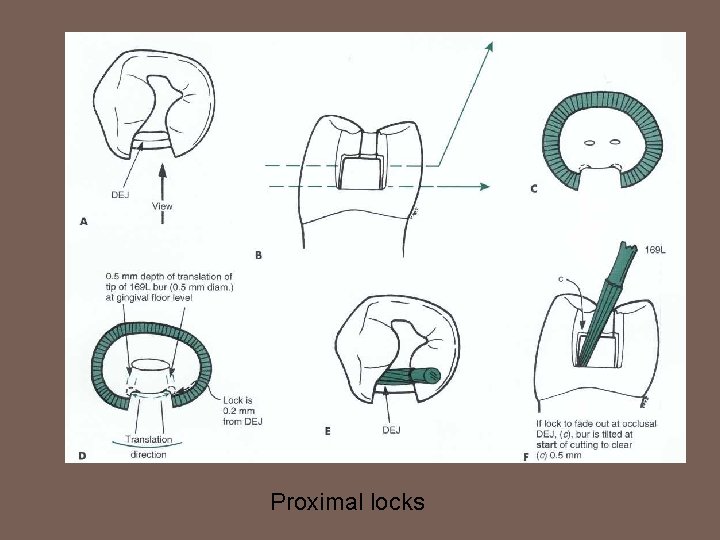 Proximal locks 