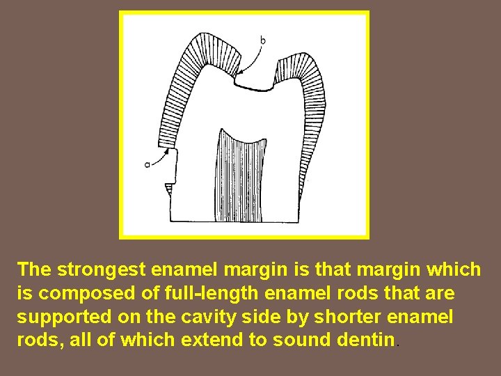 The strongest enamel margin is that margin which is composed of full-length enamel rods