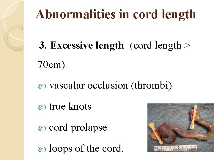 Abnormalities in cord length 3. Excessive length (cord length > 70 cm) vascular occlusion