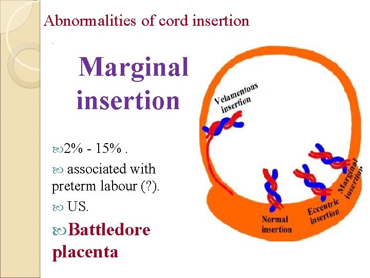 Abnormalities of cord insertion. Marginal insertion 2% - 15%. associated with preterm labour (?