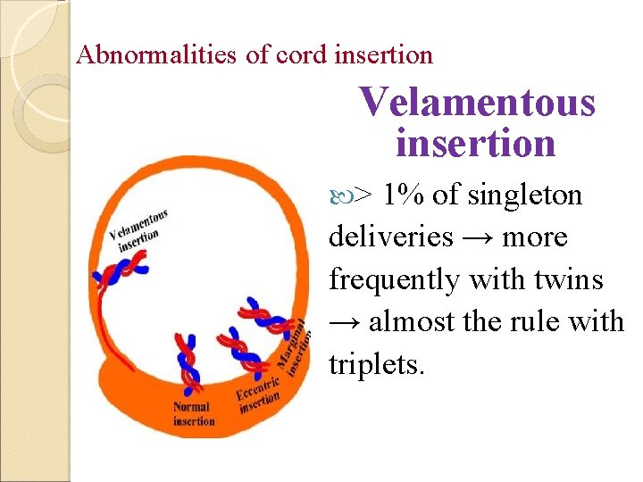 Abnormalities of cord insertion Velamentous insertion > 1% of singleton deliveries → more frequently