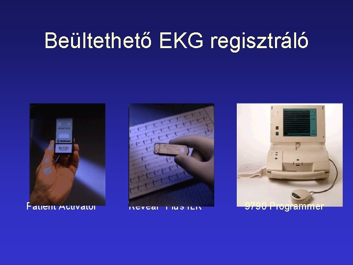 Beültethető EKG regisztráló Patient Activator Reveal® Plus ILR 9790 Programmer 