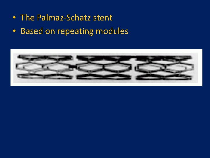 • The Palmaz-Schatz stent • Based on repeating modules   • The Palmaz-Schatz stent • Based on repeating modules