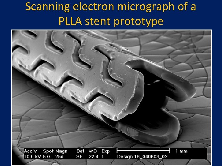 Scanning electron micrograph of a PLLA stent prototype  Scanning electron micrograph of a PLLA stent prototype