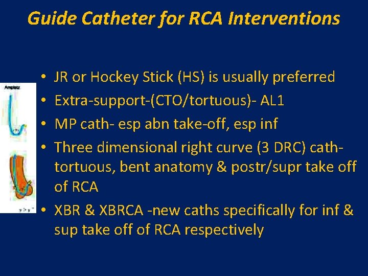 Guide Catheter for RCA Interventions JR or Hockey Stick (HS) is usually preferred Extra-support-(CTO/tortuous)- Guide Catheter for RCA Interventions JR or Hockey Stick (HS) is usually preferred Extra-support-(CTO/tortuous)-