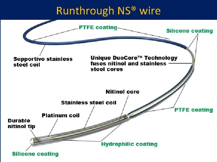 Runthrough NS® wire  Runthrough NS® wire