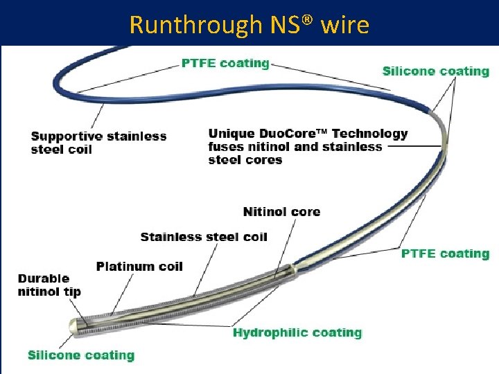 Runthrough NS® wire 