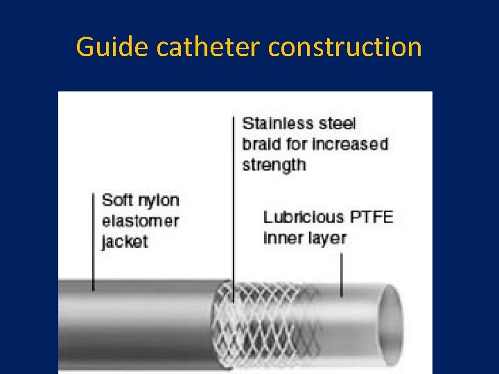 Guide catheter construction 