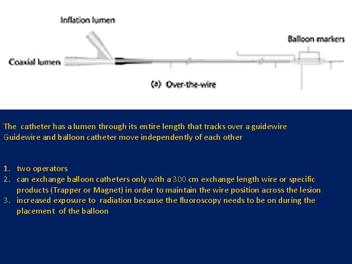 The catheter has a lumen through its entire length that tracks over a guidewire