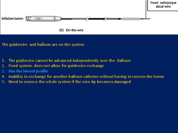 The guidewire and balloon are on the system 1. 2. 3. 4. 5. The