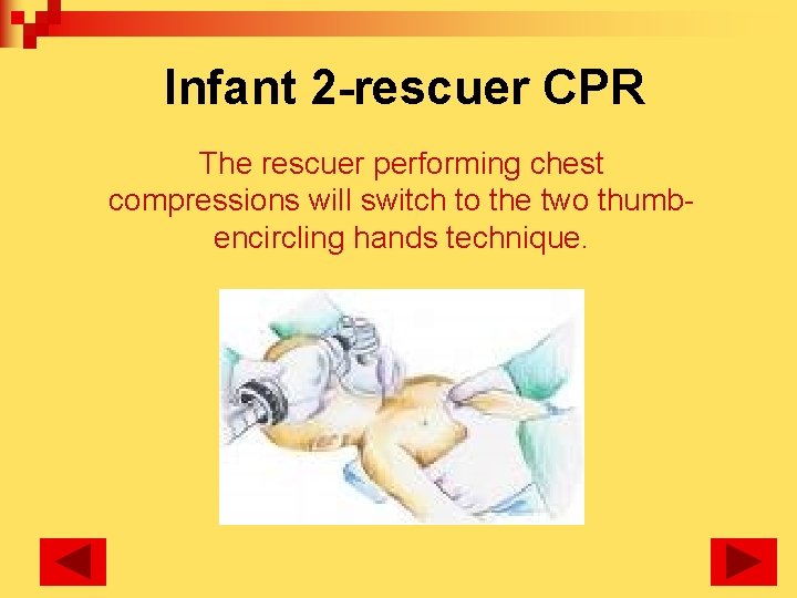 Infant 2 -rescuer CPR The rescuer performing chest compressions will switch to the two