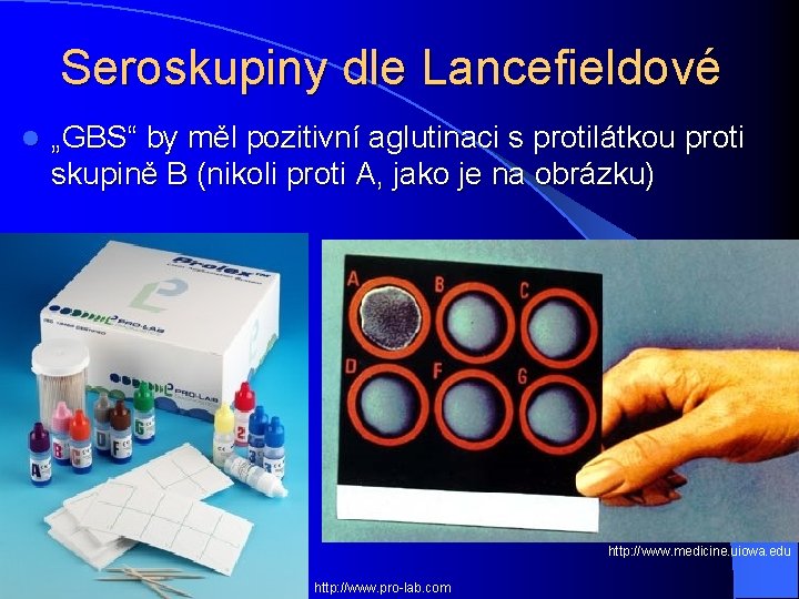Seroskupiny dle Lancefieldové l „GBS“ by měl pozitivní aglutinaci s protilátkou proti skupině B