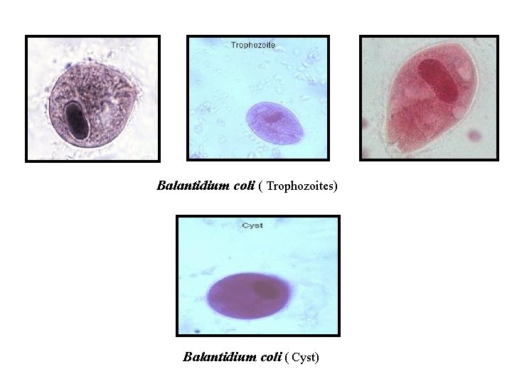 Balantidium coli ( Trophozoites) Balantidium coli ( Cyst) 