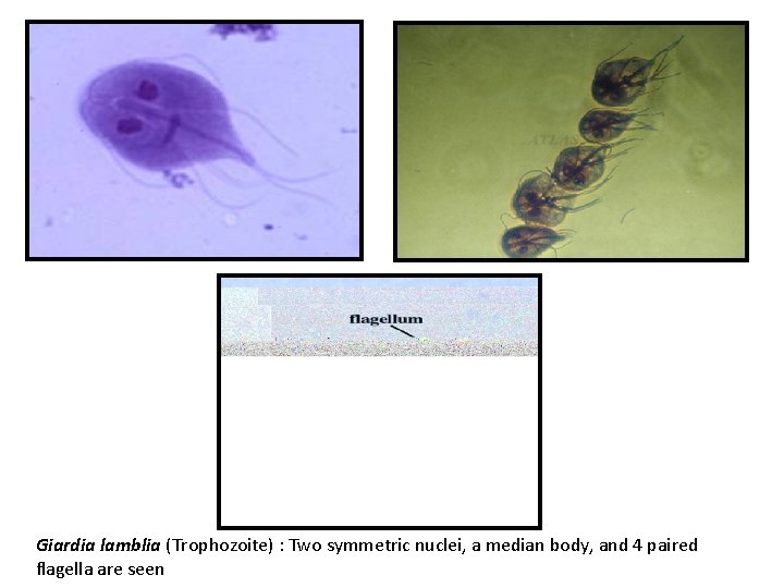 Giardia lamblia (Trophozoite) : Two symmetric nuclei, a median body, and 4 paired flagella