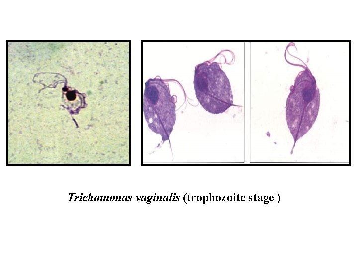 Trichomonas vaginalis (trophozoite stage ) 