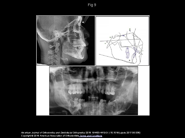 Fig 9 American Journal of Orthodontics and Dentofacial Orthopedics 2018 154433 -441 DOI: (10.