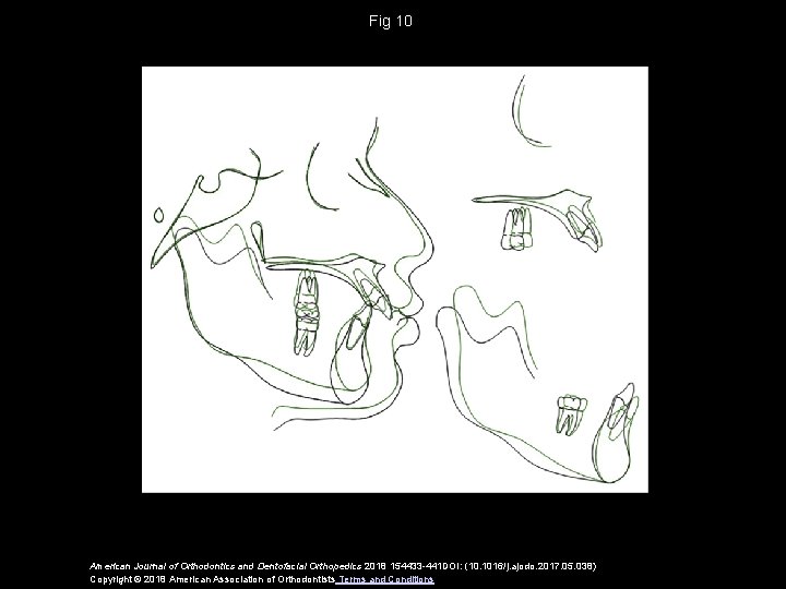 Fig 10 American Journal of Orthodontics and Dentofacial Orthopedics 2018 154433 -441 DOI: (10.