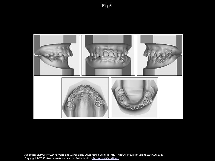 Fig 6 American Journal of Orthodontics and Dentofacial Orthopedics 2018 154433 -441 DOI: (10.