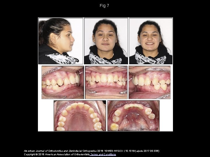 Fig 7 American Journal of Orthodontics and Dentofacial Orthopedics 2018 154433 -441 DOI: (10.