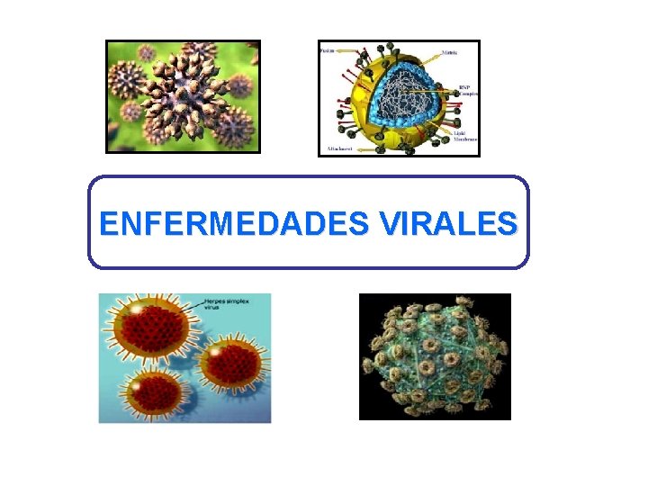 ENFERMEDADES VIRALES 