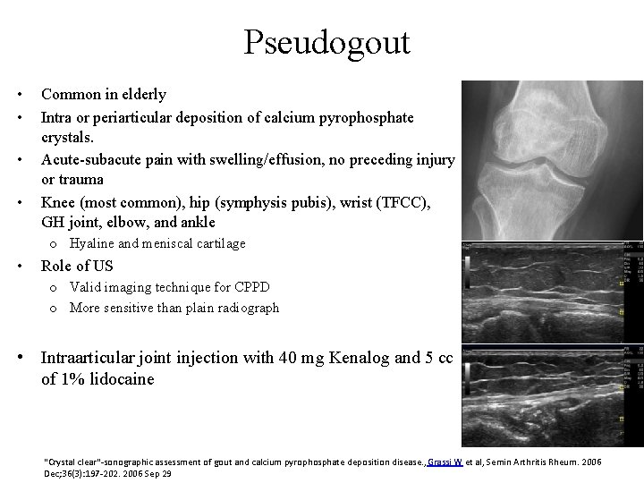 Pseudogout • • Common in elderly Intra or periarticular deposition of calcium pyrophosphate crystals.