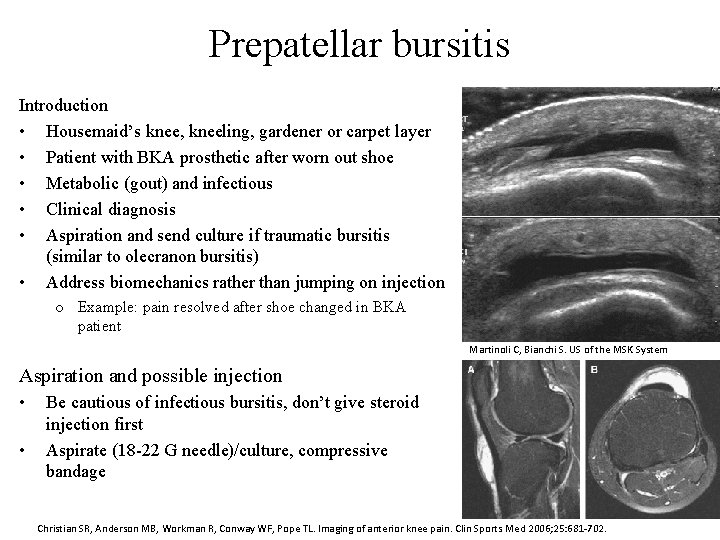 Prepatellar bursitis Introduction • Housemaid’s knee, kneeling, gardener or carpet layer • Patient with