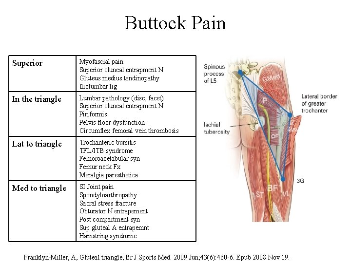 Buttock Pain Superior Myofascial pain Superior cluneal entrapment N Gluteus medius tendinopathy Iliolumbar lig