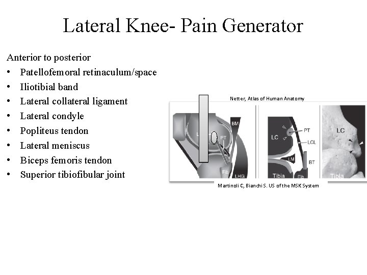 Lateral Knee- Pain Generator Anterior to posterior • Patellofemoral retinaculum/space • Iliotibial band •