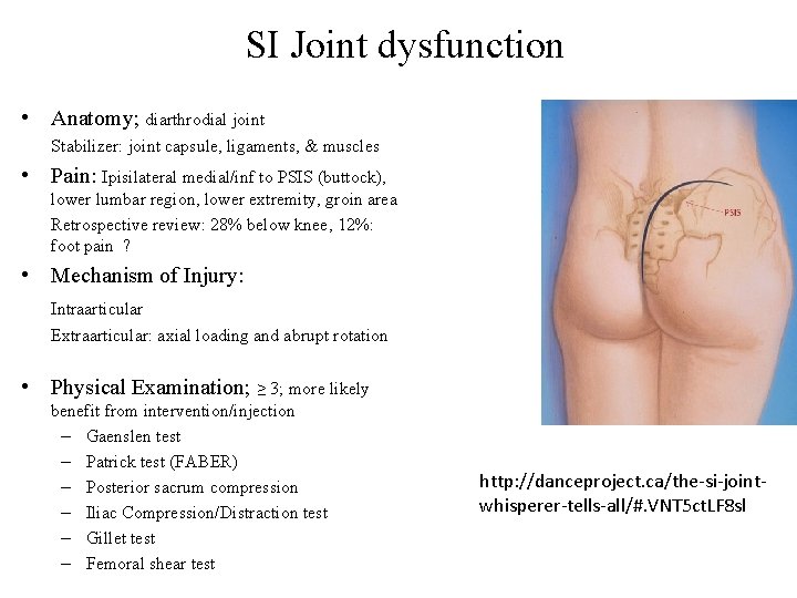 SI Joint dysfunction • Anatomy; diarthrodial joint Stabilizer: joint capsule, ligaments, & muscles •
