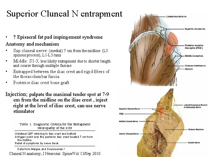 Superior Cluneal N entrapment • ? Episacral fat pad impingement syndrome Anatomy and mechanism