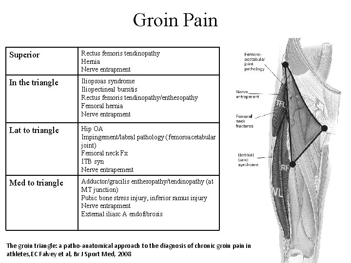 Groin Pain Superior Rectus femoris tendinopathy Hernia Nerve entrapment In the triangle Iliopsoas syndrome