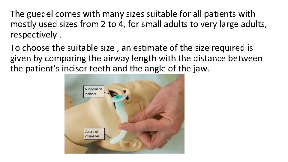 The guedel comes with many sizes suitable for all patients with mostly used sizes The guedel comes with many sizes suitable for all patients with mostly used sizes