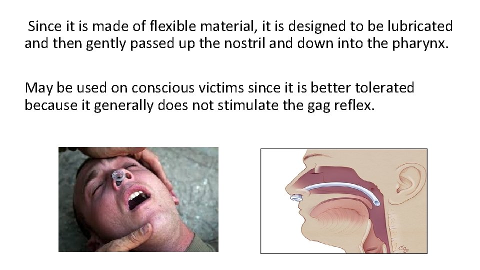 Since it is made of flexible material, it is designed to be lubricated Since it is made of flexible material, it is designed to be lubricated