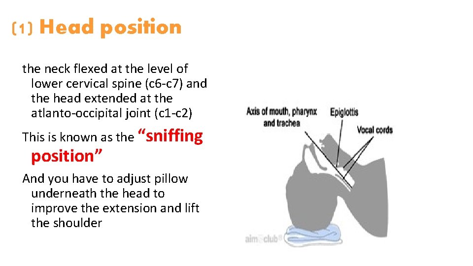 (1) Head position the neck flexed at the level of lower cervical spine (c (1) Head position the neck flexed at the level of lower cervical spine (c