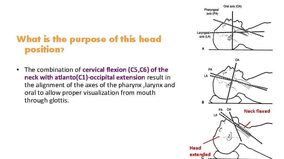 What is the purpose of this head position? • The combination of cervical flexion