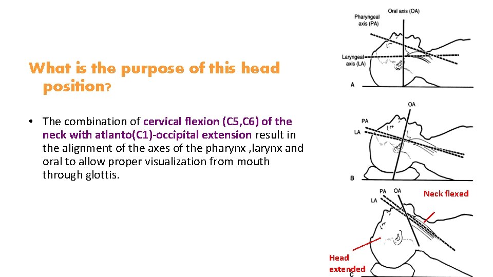 What is the purpose of this head position? • The combination of cervical flexion What is the purpose of this head position? • The combination of cervical flexion