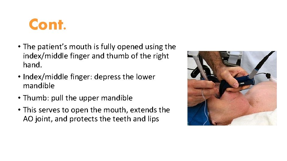 Cont. • The patient’s mouth is fully opened using the index/middle finger and thumb