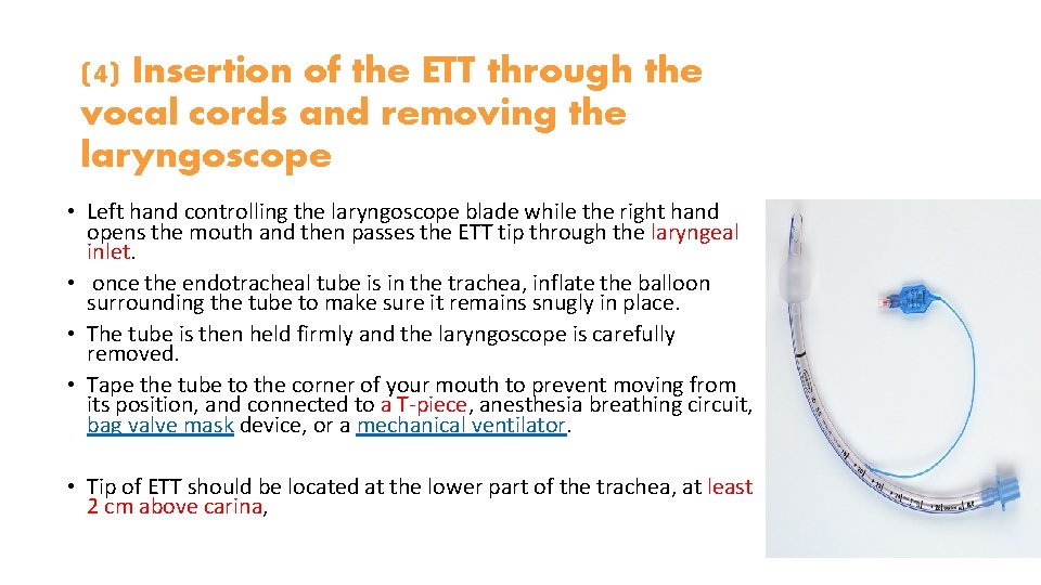 (4) Insertion of the ETT through the vocal cords and removing the laryngoscope • (4) Insertion of the ETT through the vocal cords and removing the laryngoscope •