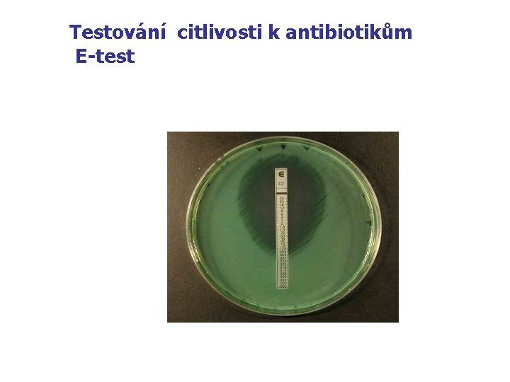 Testování citlivosti k antibiotikům E-test 