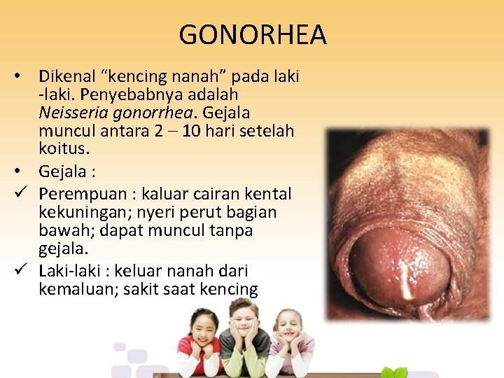 GONORHEA • Dikenal “kencing nanah” pada laki -laki. Penyebabnya adalah Neisseria gonorrhea. Gejala muncul