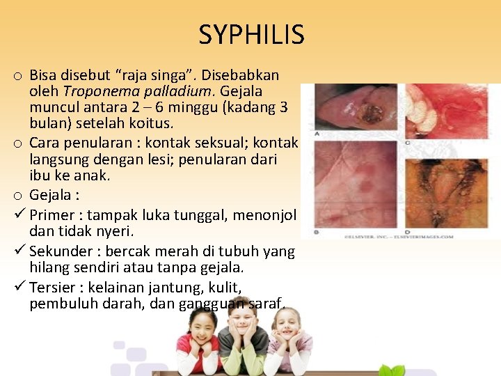 SYPHILIS o Bisa disebut “raja singa”. Disebabkan oleh Troponema palladium. Gejala muncul antara 2